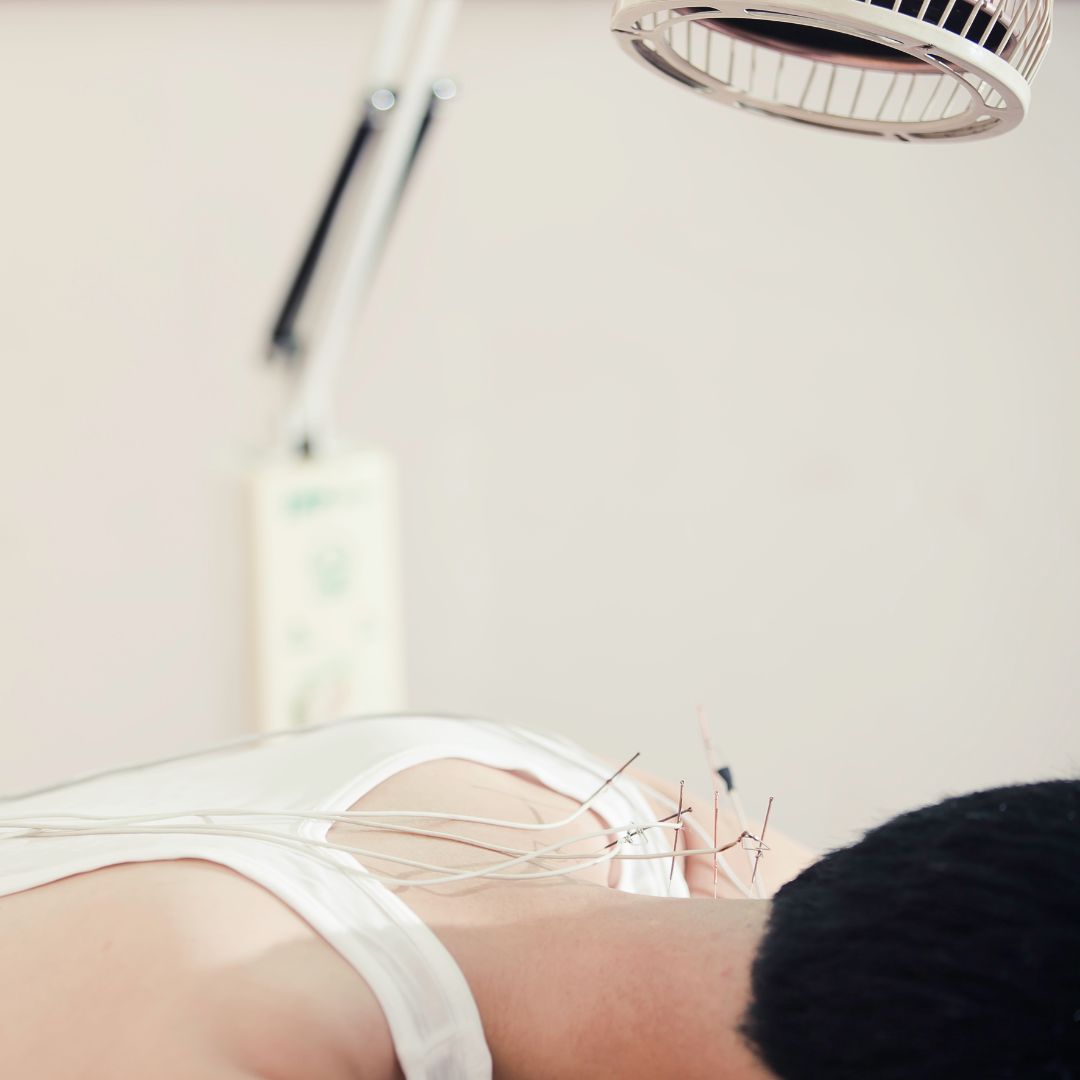 A Comprehensive Introduction to Medical Acupuncture