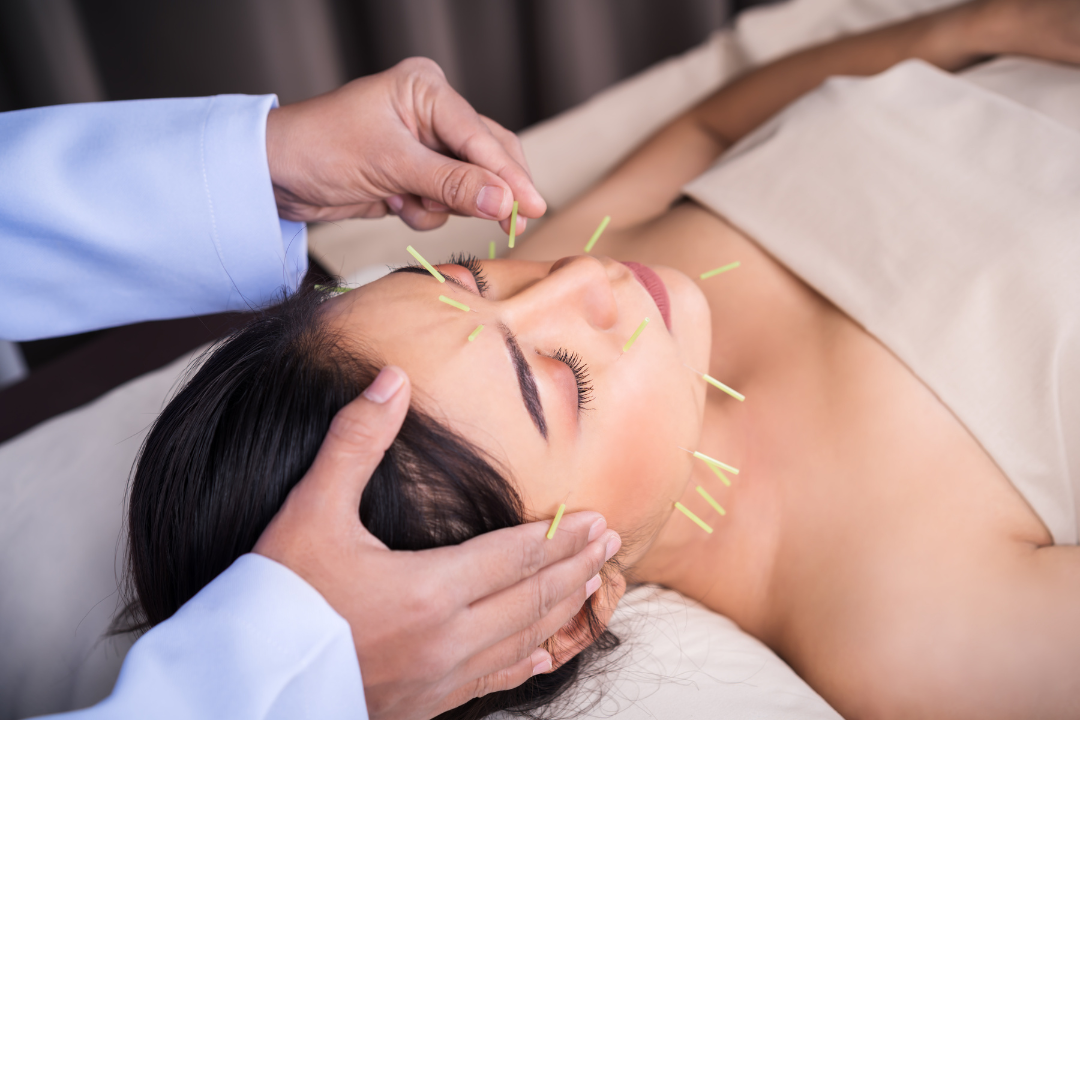 acupuncture-for-stress-2 acupuncture-for-stress-2