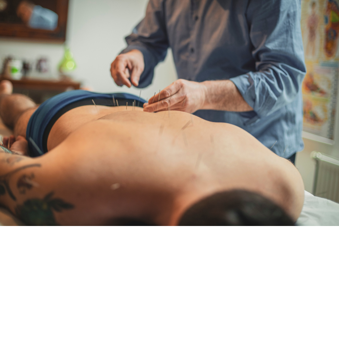 acupuncture-for-stress acupuncture-for-stress