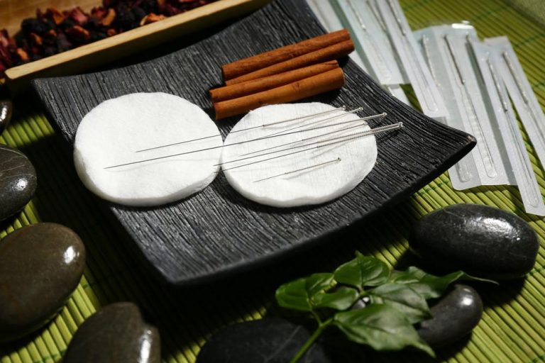 history-of-acupuncture-4 history-of-acupuncture-4