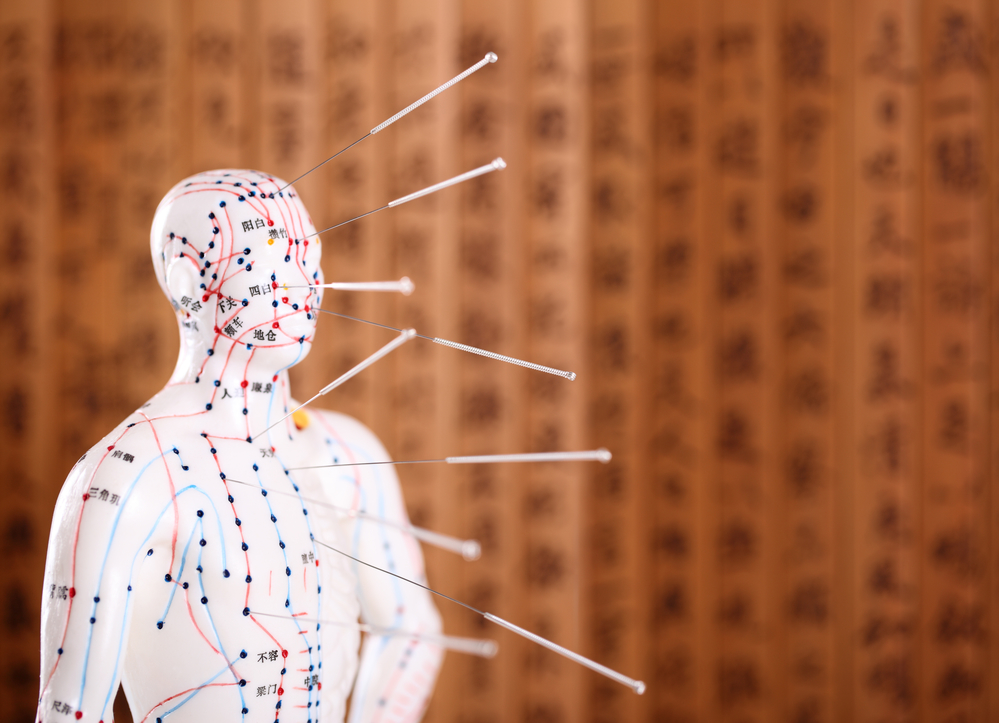 history-of-acupuncture