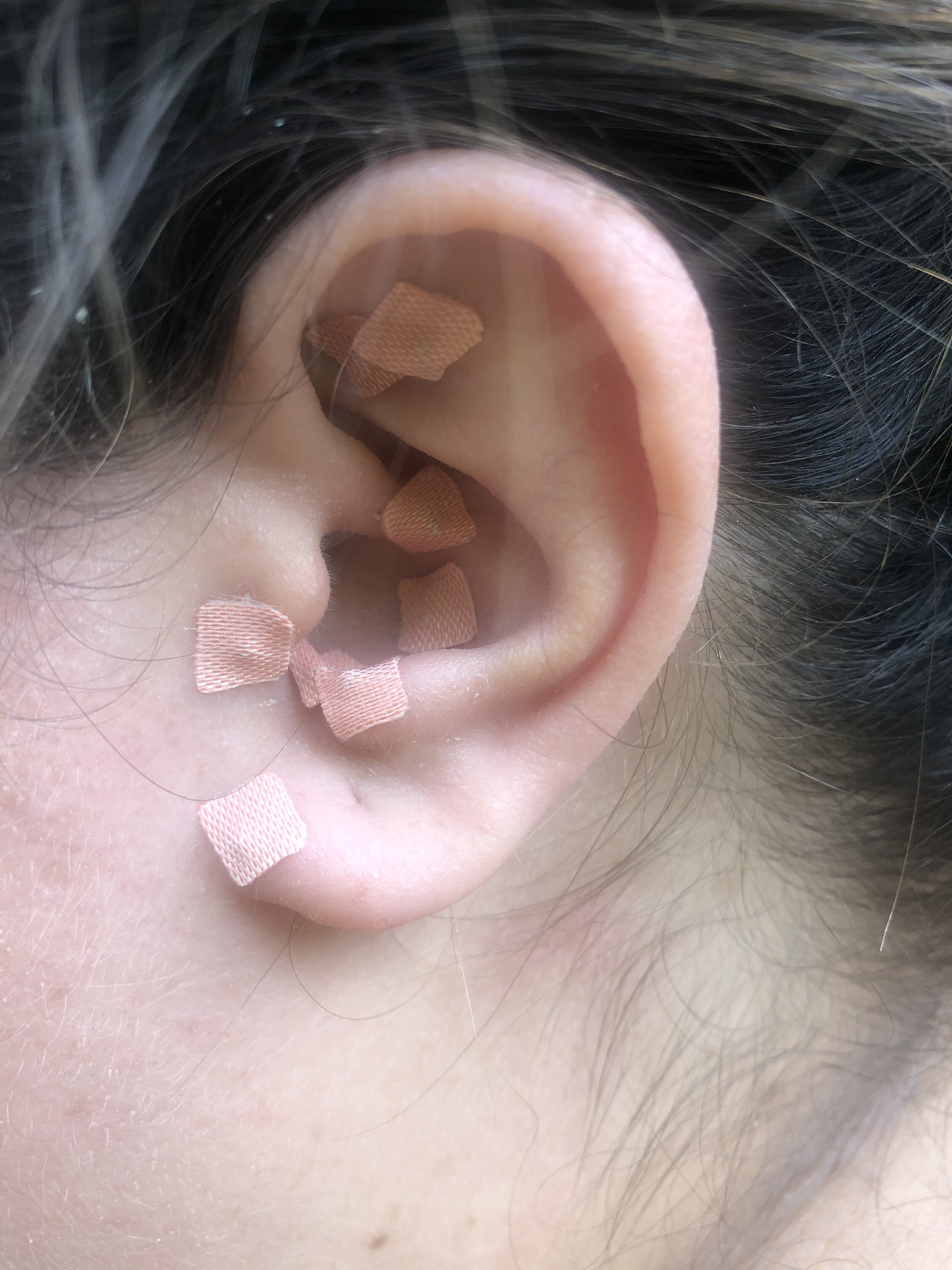 weight-loss-2 weight-loss-2